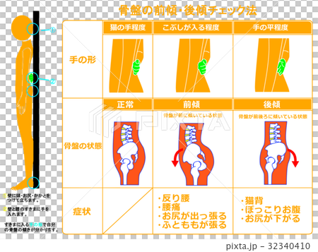 Front anteversion / posterior inclination checking method of pelvis (orange color · with explanation) 32340410