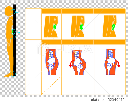 骨盤の前傾 後傾チェック法 オレンジ色 説明なし のイラスト素材