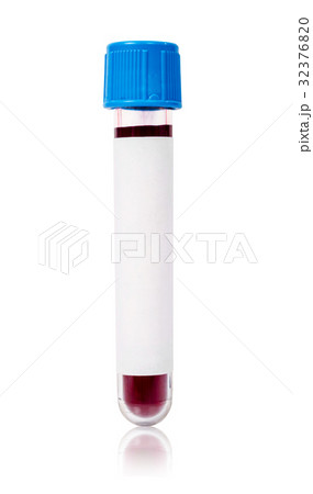 Blue vacuum blood tube test with sample blood. Blue vacuum blood tube test with sample blood. 32376820
