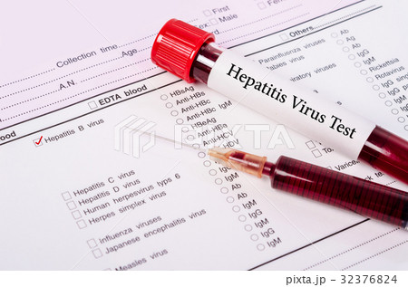 World hepatitis day concept. 32376824