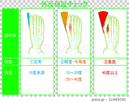 Progress degree check of hallux valgus (green · description included) 32469595