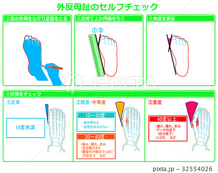 外反母趾のセルフチェック2（緑色・説明あり） 32554026
