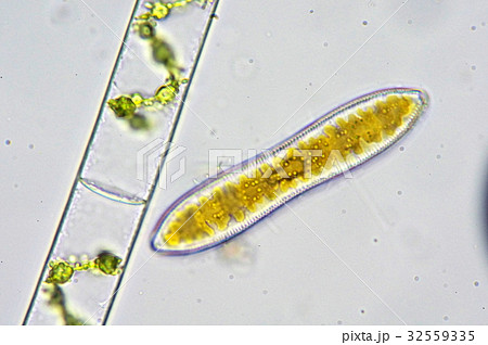 アオミドロと珪藻(顕微鏡写真) アオミドロと珪藻(顕微鏡写真) 32559335