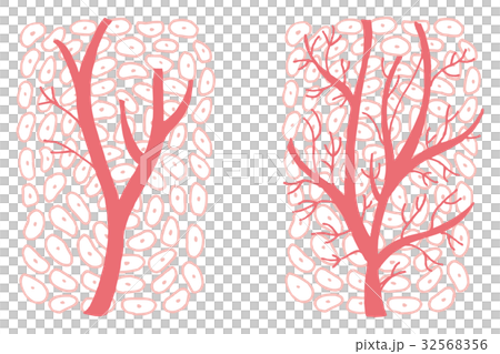毛細血管の新生 毛細血管の新生 32568356