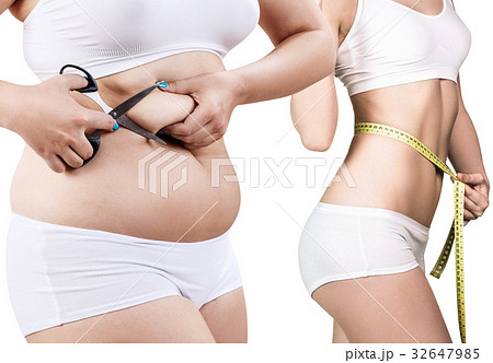 Woman's body before and after weight loss. 32647985