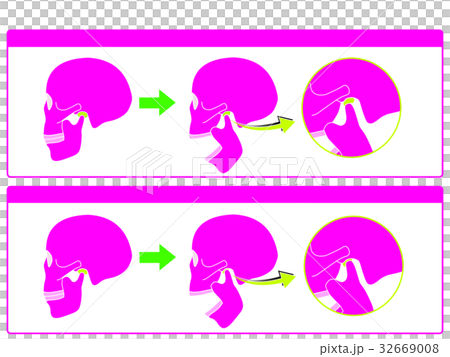 Normal temporomandibular joint and temporomandibular joint disease 5 (pink color and no character) 32669008