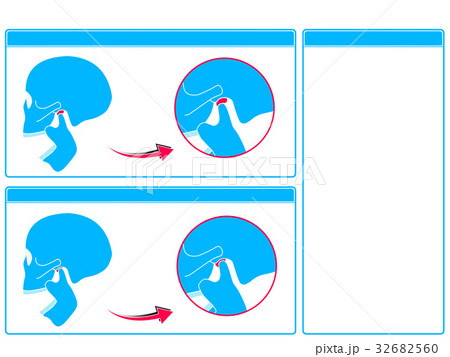 顎関節症のチェック2（青色・文字なし） 32682560