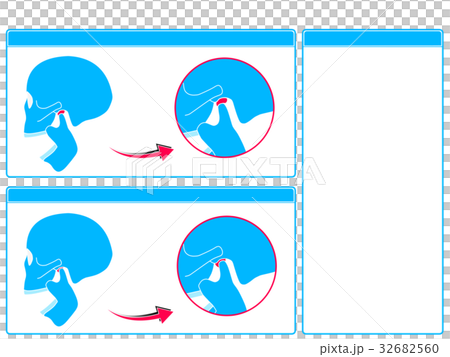 顎関節症のチェック2（青色・文字なし） 32682560