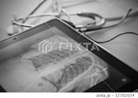 x ray picture in touchscreen device x ray picture in touchscreen device 32702034