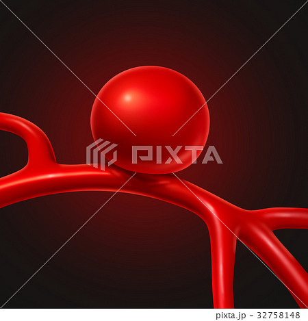 Aneurysm Aneurysm 32758148