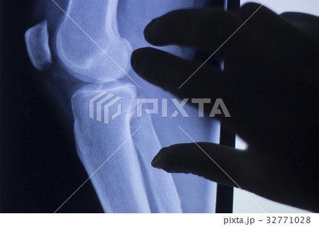 Knee joint xray test scan Knee joint xray test scan 32771028
