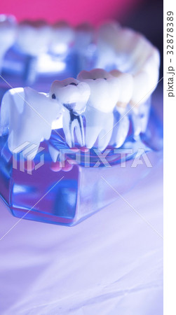 Dental tooth root canal Dental tooth root canal 32878389