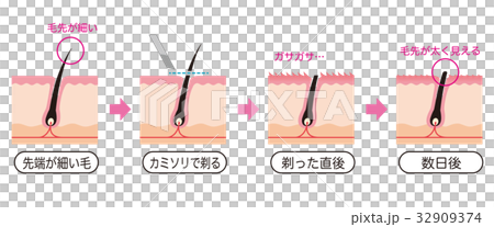 Cross section view of waste hair treatment razor hair 32909374
