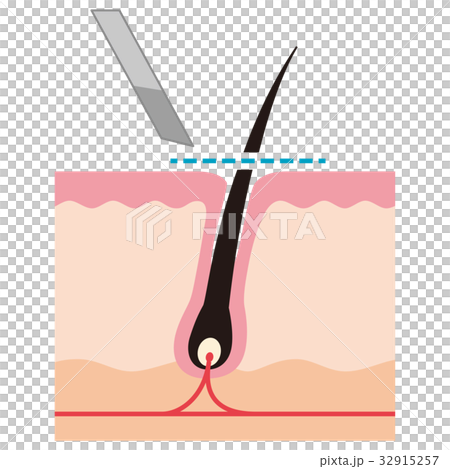 Cross section view of waste hair treatment razor hair 32915257