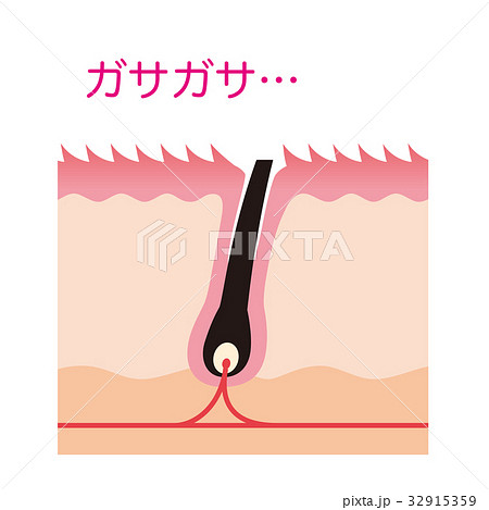 ムダ毛処理　カミソリ　毛の断面図 32915359
