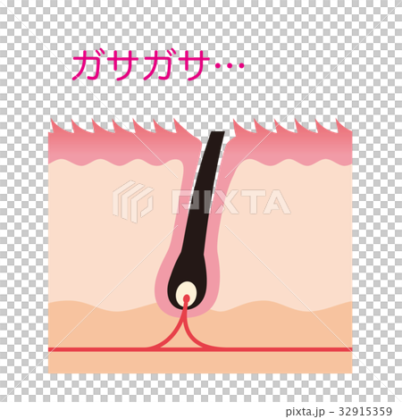 ムダ毛処理　カミソリ　毛の断面図 32915359