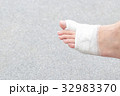 Injured feet with wounds.Wound on the foot of pati 32983370