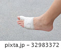 Injured feet with wounds.Wound on the foot of pati 32983372