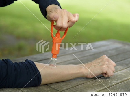 腕の毒吸出し 32994859