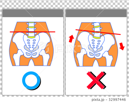 骨盤のゆがみ（正常・ゆがみ）の比較（灰色・言葉なし）　 32997446