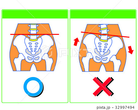 骨盤のゆがみ（正常・ゆがみ）の比較（緑色・言葉なし）　 32997494