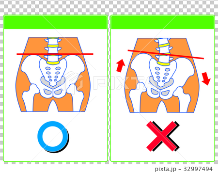 骨盤のゆがみ（正常・ゆがみ）の比較（緑色・言葉なし）　 32997494