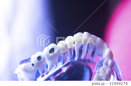 Dental tooth health decay Dental tooth health decay 32999279