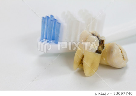 Tooth decay dental caries and tooth brush Tooth decay dental caries and tooth brush 33097740