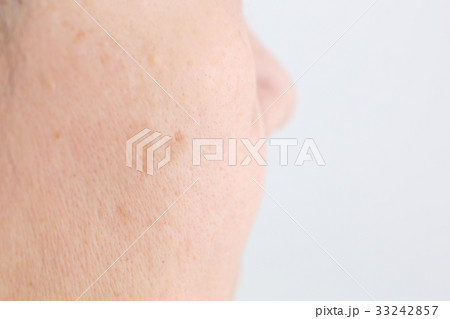 シミ　イメージ 33242857