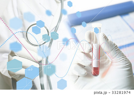 医療・研究イメージ　血液検査 33281974