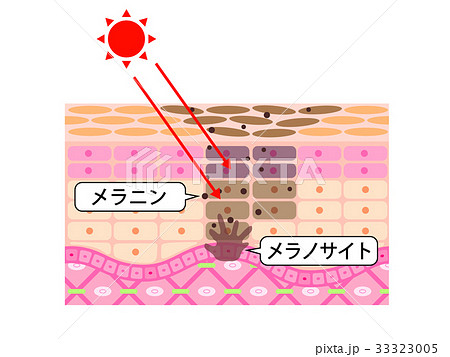 Skin Sectional View Sunburn Stain Stock Illustration