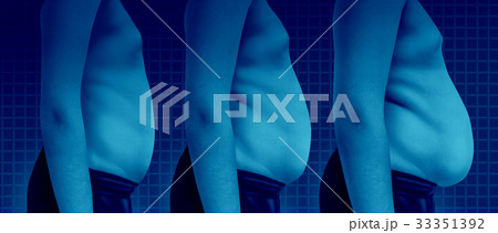 Child Gaining Weight Child Gaining Weight 33351392