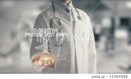 Doctor holding in hand C-Reactive Protein Test CRP 33364998