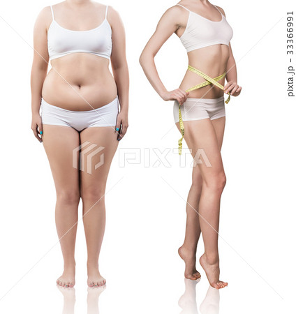 Woman's body before and after weight loss. 33366991