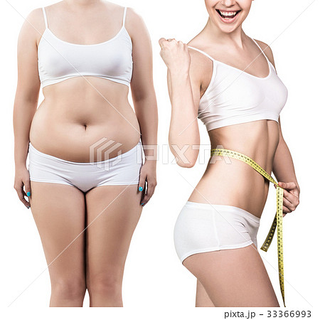 Woman's body before and after weight loss. 33366993