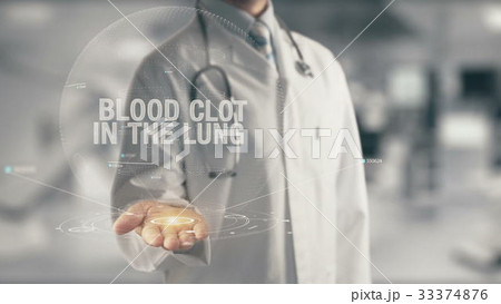 Doctor holding in hand Blood Clot in the Lung 33374876