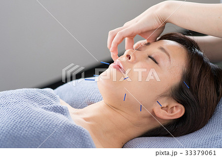 美容 鍼 ビューティー ミドル 女性 美容鍼 イメージ 美容 鍼 ビューティー ミドル 女性 美容鍼 イメージ 33379061