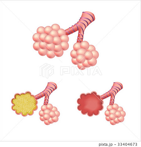 Alveoli In Setのイラスト素材