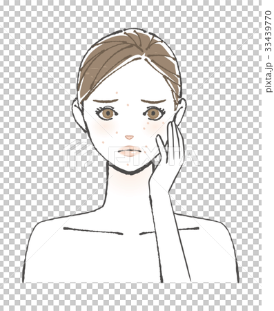 皮膚問題粉刺例證 皮膚問題粉刺例證 33439770