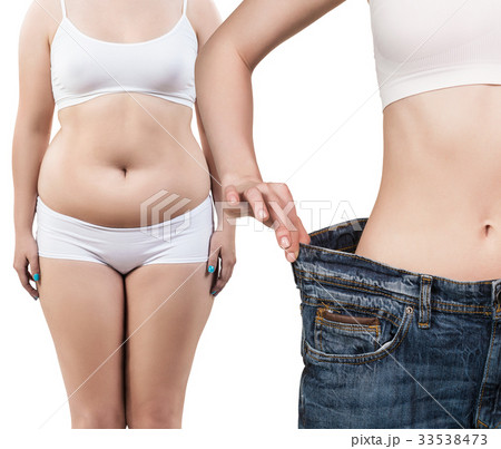 Woman's body before and after weight loss. Woman's body before and after weight loss. 33538473