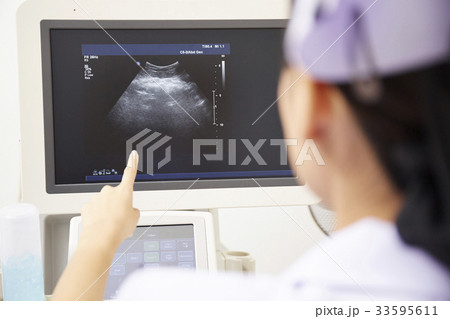 a nurse is pointing at the picture on the scanner screen 33595611