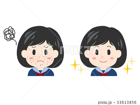 女性 悩み 学生 ニキビ イラスト 33613856