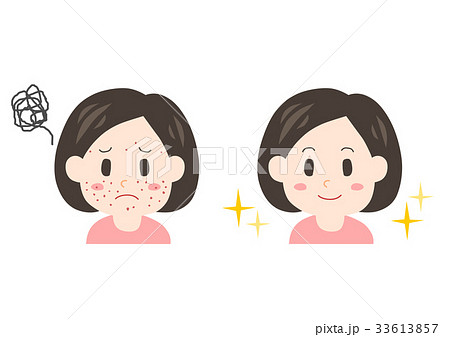 女性 悩み 中年 ニキビ イラストのイラスト素材