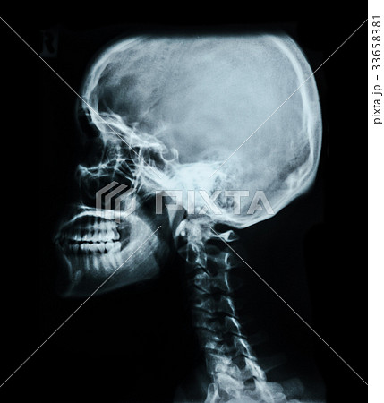 Human skull X-ray image. 33658381