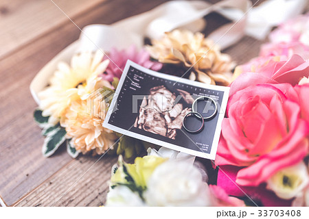 エコー写真 33703408