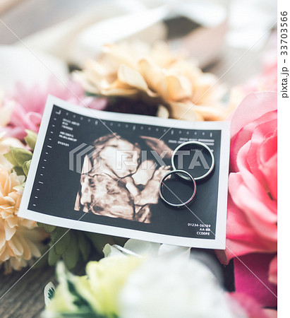 胎児 胎児 33703566