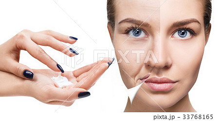 Woman's face before and after rejuvenation. 33768165