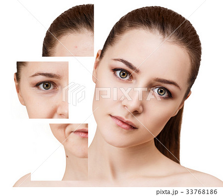 Woman's face before and after rejuvenation. 33768186