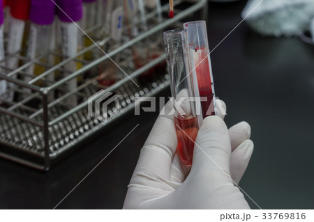 Pipette dropping a sample in test tube Pipette dropping a sample in test tube 33769816