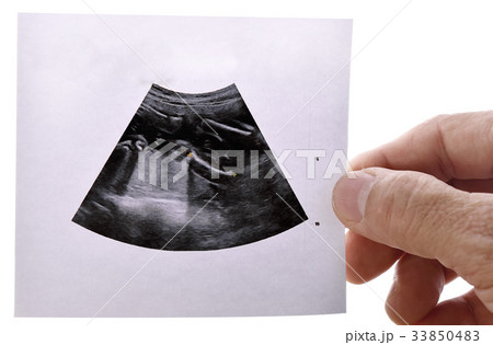 Ultrasound baby report hand on white backgroug Ultrasound baby report hand on white backgroug 33850483